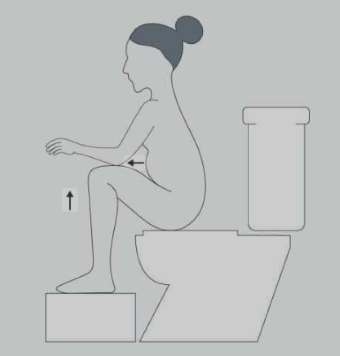 Illustration of woman sitting on toilet with feet on a stool, knees bent, and leaning forwards with elbows on knees