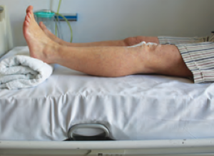 Person lying on bed with leg straight and ankle rested on a rolled up towel