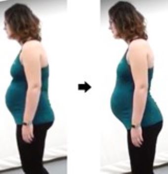 Posture changes through pregnancy