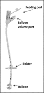 RIG tube diagram