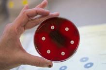 A hand holding petri dish with visible cultures